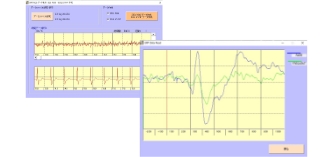 認知機能・注意力の見える化