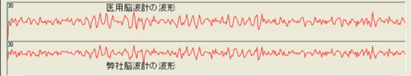 脳波計比較
